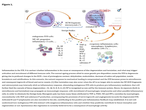 Inflammation in intervertebral disc degeneration and regeneration.